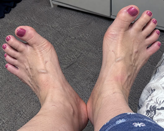 Rennaise avec un petit faible pour les adorateurs de pieds